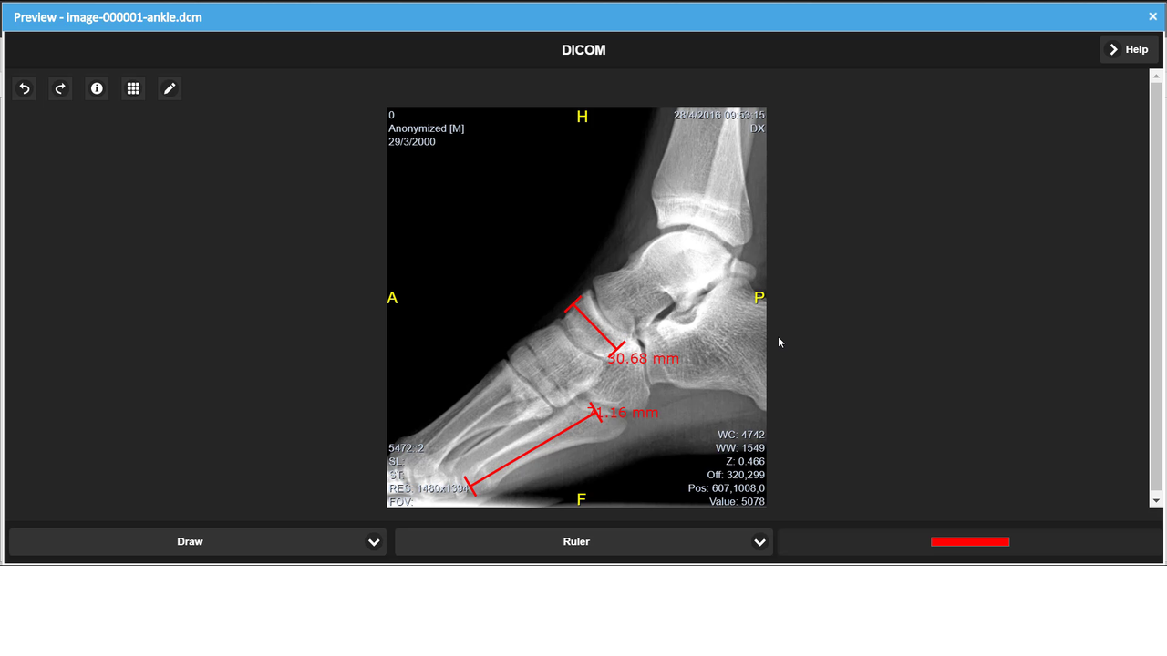 Native DICOM Image Preview