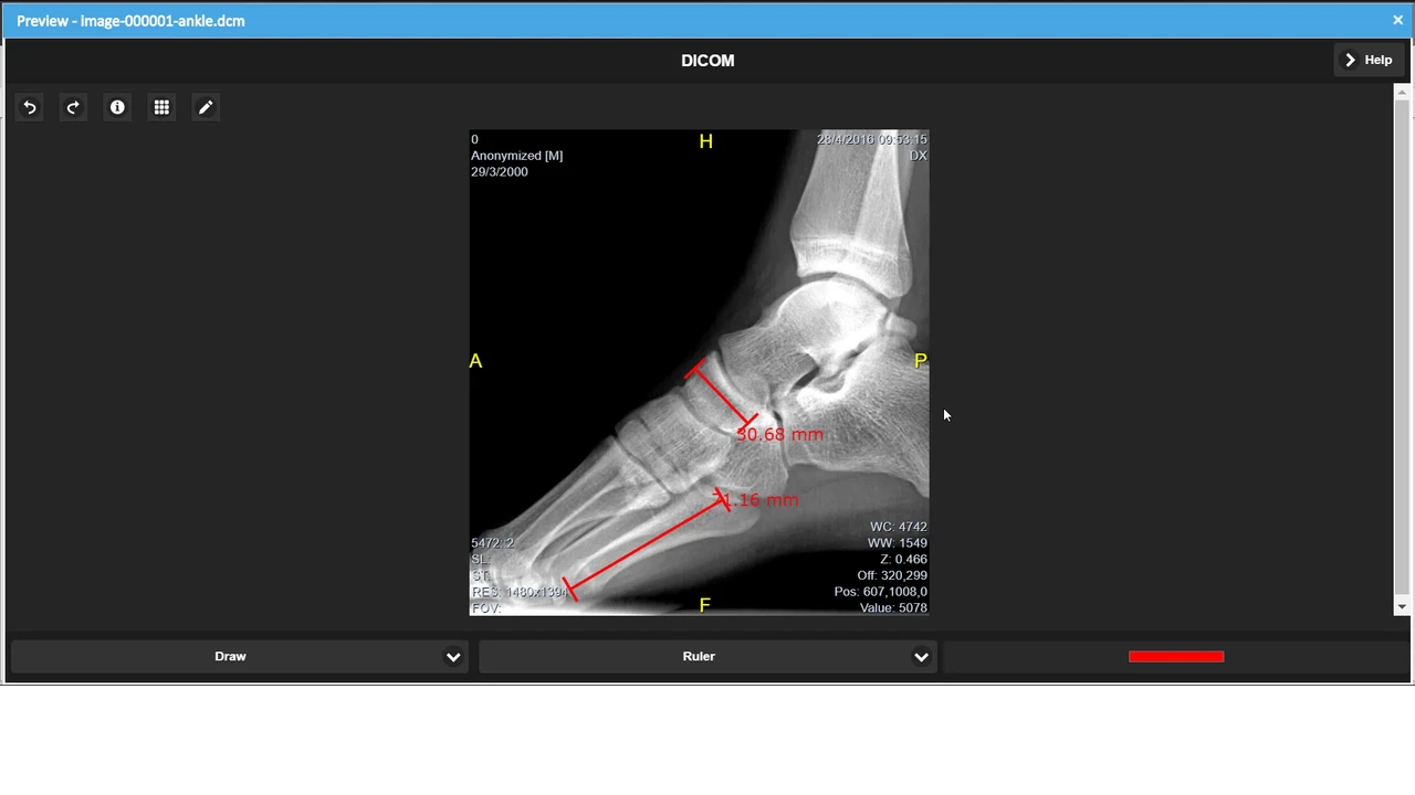 Native DICOM Image Preview