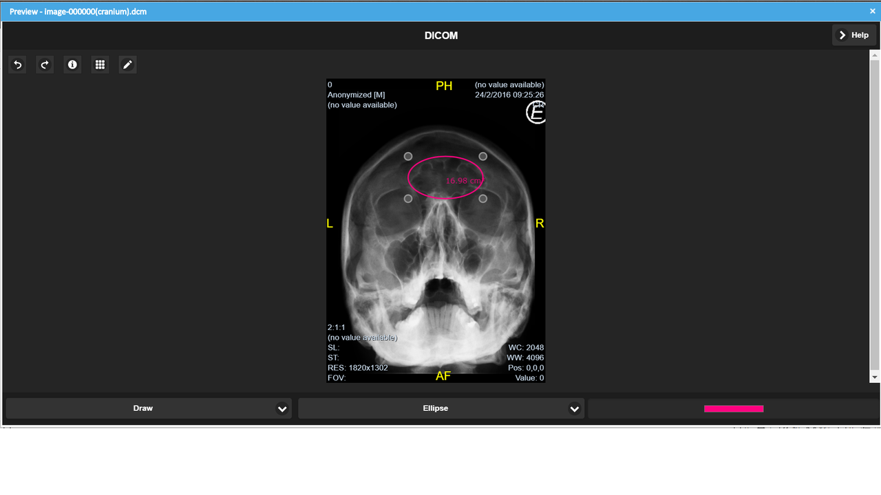 Measure and Annotate Medical Images